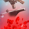 Гемосканирование (сканирование, диагностика по капле крови) - 30%